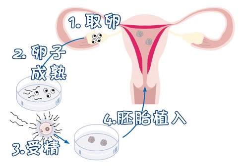 代生选性别包男孩生殖中心